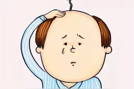 熬夜一时爽，秃头毁终生！三个方法让你避免熬夜脱发图片
