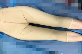 大腿粗壮想变瘦变好看？做大腿环吸时，医生要处理好这4个部位图片