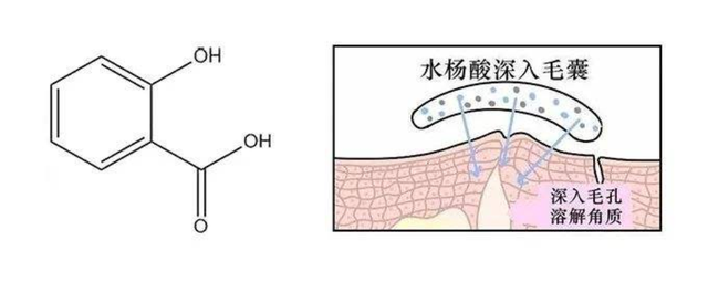 角鲨烷烟酰胺身体乳