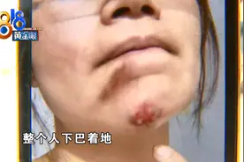 骑“捷安特”过减速带，前轮飞了，下巴着地......图片