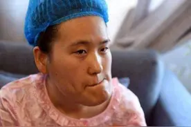歪脸女孩“换头”重生，年薪100万仍不为所动，姥姥:不愁找对象了图片
