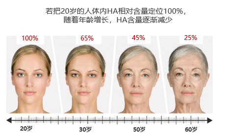 鐜诲翱閰革紝閫忔槑璐ㄩ吀锛岀幓鐠冮吀