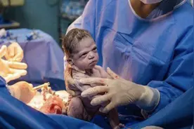 “臭脸宝宝”出生照火了，刚出生就怒瞪医生，网友：萌翻了图片