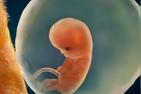 孕吐反应真的和孩子的智商有关系吗？加拿大研究院证实了图片