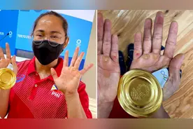 专业运动员让人震惊的照片，让你对人体有了新的认识图片