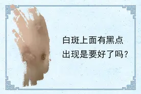 白斑上面有黑点出现是要好了吗图片