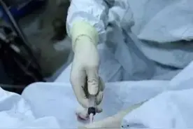 来看看人流手术的全过程！手术后应注意什么？图片