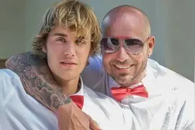 Justin Bieber 脂溢性脱发，有秃顶的前兆了…图片