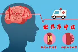 脑卒中的九大误区，您了解吗 | 世界卒中日图片