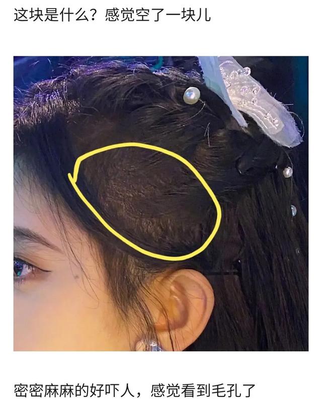 耳朵前鬓角下鸡皮疙瘩红印