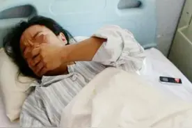 孕期发生胎停，可能是胎儿缺氧导致，3种宝宝缺氧信号孕妈要知道图片
