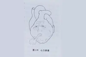 科普：如何判断是心力衰竭还是心功能不全？2种疾病哪个会要命？图片