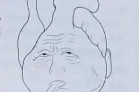 科普：如何判断是心力衰竭还是心功能不全？2种疾病哪个会要命？图片