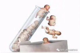 辅助生殖常见问题之——试管婴儿篇图片