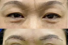 46岁的周迅为什么能够重回年轻化，来看看我们的面部如何抗衰老图片