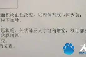痛心！被爸爸举高高摔进ICU的男婴，已下三次病危通知书，医生：希望不大了图片