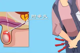 附睾炎会搞出不育？硬核科普附睾炎的秘密图片