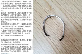 只因一只银镯，11个月女童手肘脱位，大哭不止！家长小心图片