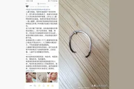 只因一只银镯，11个月女童手肘脱位，大哭不止！家长小心图片