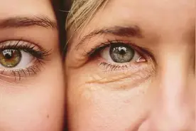 肌肤糖化太可怕，你开始抗糖了吗？图片