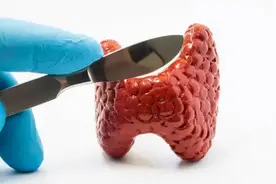 “懒”出名的癌症，勤快起来比癌中之王可怕！5大高危人群要注意图片