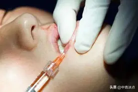 整形医院里稚嫩脸庞越来越多，业内竟有“学生整容季”，未成年人整形还有“入门项目”图片