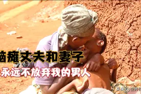 非洲脑瘫夫妻结婚27年，每天嘴对嘴喂饭给丈夫，爱情和金钱无关图片