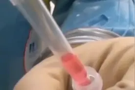 猪有救了！非洲猪瘟疫苗即将进入临床试验阶段视频封面