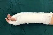 健康科普堂 | 手功能障碍的康复治疗图片