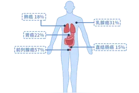 一家七口全患癌！警告：得了这5种癌症，可能“遗传”给下一代图片