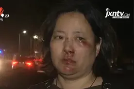 南昌：女子骑车磕掉7、8颗牙！她说太黑了，一个路灯都没有图片