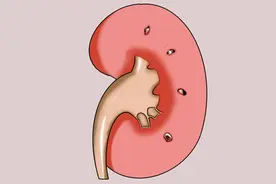 换肾就能治好尿毒症了？那些换了肾的人，还能活多长时间？图片