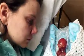 还记得出生比圆珠笔高几厘米“拇指姑娘”吗？14年过去，她咋样了图片