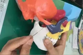 摆脱鼻炎困扰 试试针刺治疗“一针见效”图片