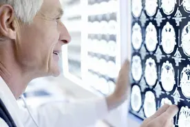 经常头痛，做了CT也找不到原因，多半是这两种头痛，对症治疗即可图片