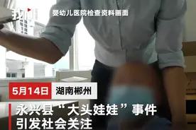 大头娃娃事件家长拒绝退一赔三：解决不了孩子健康问题图片