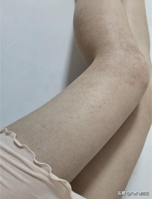 怎么制作腿上的鸡皮肤