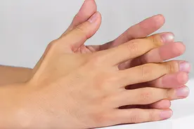 手上青筋越多，代表身体越差？青筋凸起，与什么有关？图片