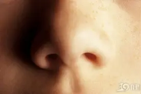 为什么鼻毛会“窜”出来？鼻毛长得太茂盛，能不能拔掉？图片