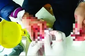 触目惊心！坦洲男子被风扇割断食指，血流不止洒一地！医生：太严重！图片