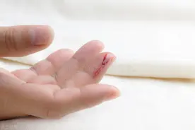 血亏！！！图片