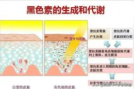激光危险大，保健品不靠谱！最实用祛斑方法，只靠护肤品就可以图片