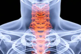 牵引，十天以上才有效图片