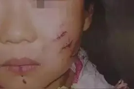 随处可见却容易被忽视的幼儿安全杀手！这个假期要防患于未然图片