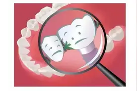 “突然发现开始塞牙了！”咋回事啊图片