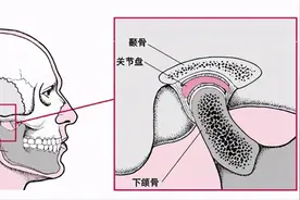 那些爱打哈欠的人，嘴千万别张太大，有这个症状要小心图片
