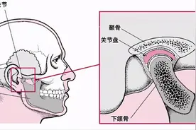 那些爱打哈欠的人，嘴千万别张太大，有这个症状要小心图片