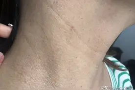 40岁女性脖颈纹明显，看看这三点你是否注意图片