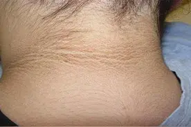 娃天天洗澡脖子还“黑黢黢”，多半是饮食有问题，教你几招可改善图片