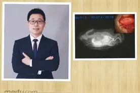 南大二附院肖爵贤医师荣获全国神经外科术中血管荧光造影网络病例三等奖图片